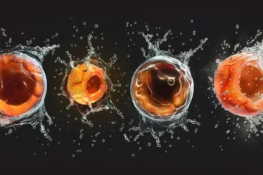 Apoptoza – celica se skrči in razpade v apoptotska telesca, ki jih fagociti odstranijo brez vnetja